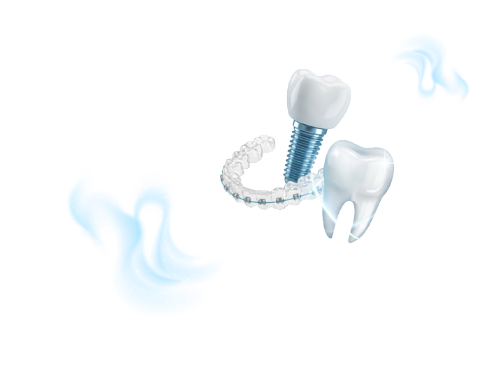 Новая улыбка опрос